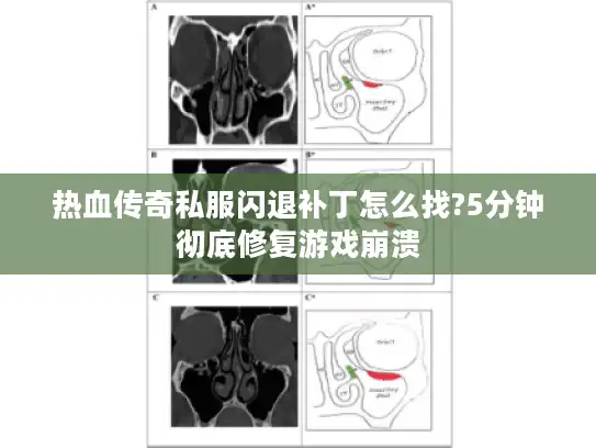 热血传奇私服闪退补丁怎么找?5分钟彻底修复游戏崩溃