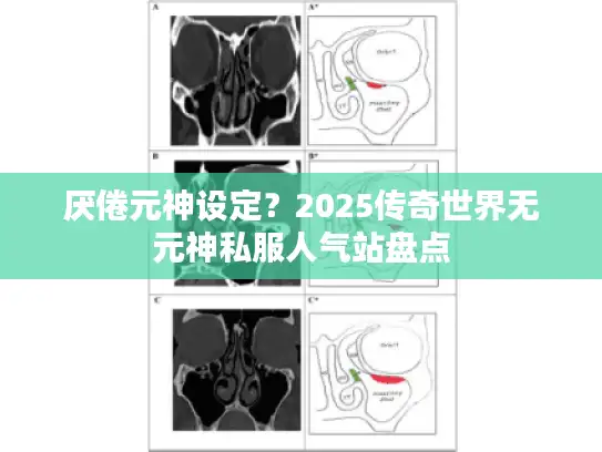 厌倦元神设定？2025传奇世界无元神私服人气站盘点