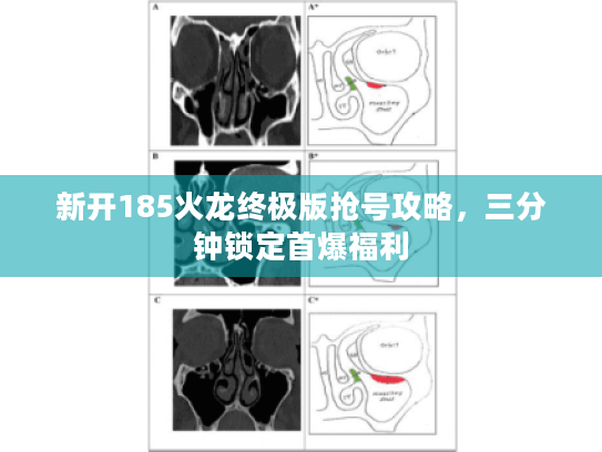 新开185火龙终极版抢号攻略，三分钟锁定首爆福利