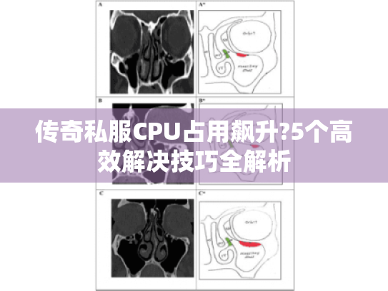 传奇私服CPU占用飙升?5个高效解决技巧全解析 传奇私服CPU占用飙升?5个高效解决技巧全解析