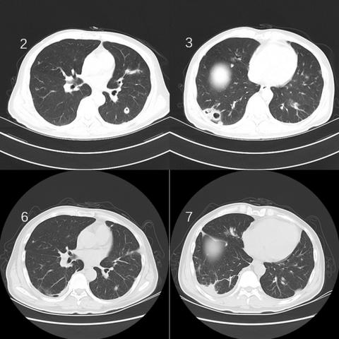 《空洞骑士丝之歌深度评测：玩法解析+难度挑战，体验非凡游戏魅力》