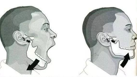 煎饼加料吃到下巴脱臼？深扒颞下颌关节紊乱的隐形杀手与自救指南