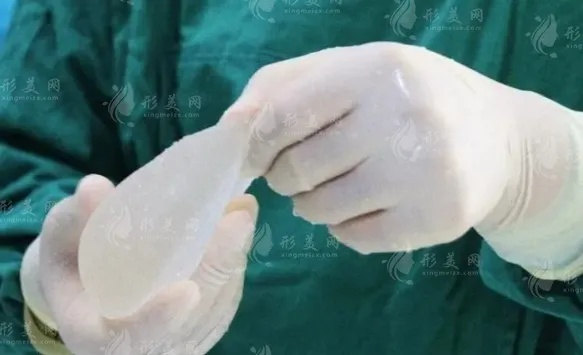 2026年隆胸怎么选?深扒假体与自体脂肪的真实痛感与手感 2026年隆胸怎么选?深扒假体与自体脂肪的真实痛感与手感